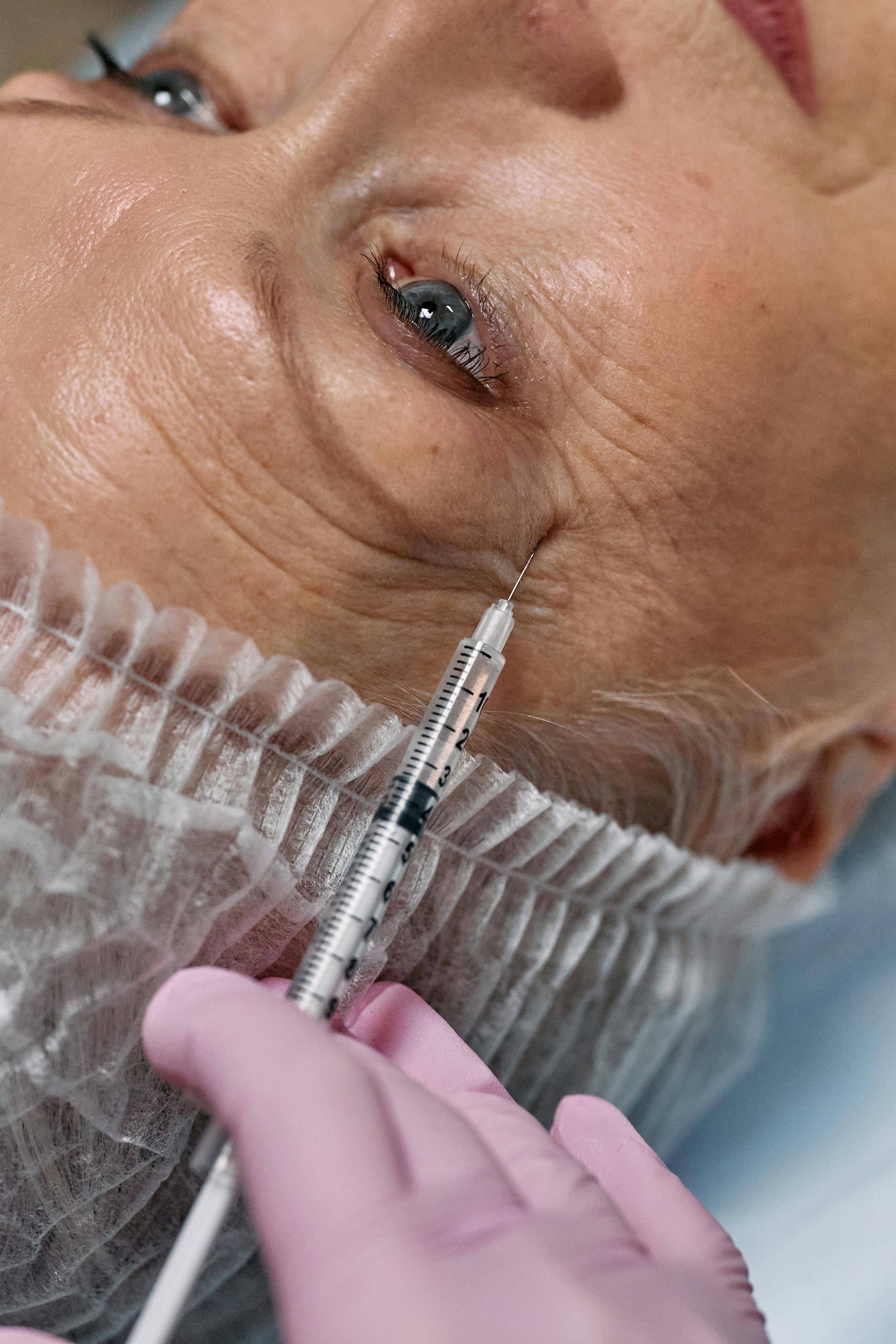 Plasma Injection